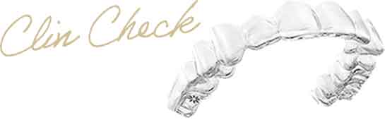 クリンチェック